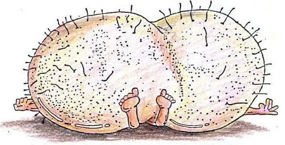testicoli_giganti.webp
